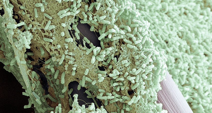 Pseudomonas aeruginosa