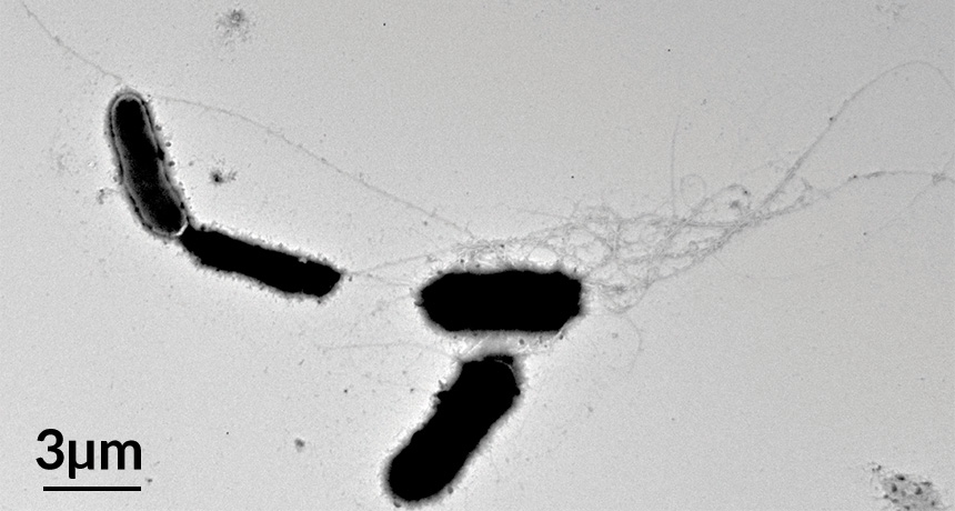 A-beta fibrils ensnare yeast cells