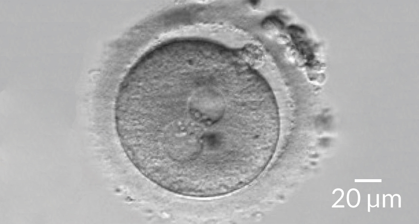 egg