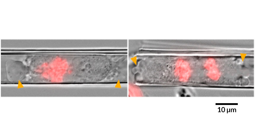 cancer nanotubes