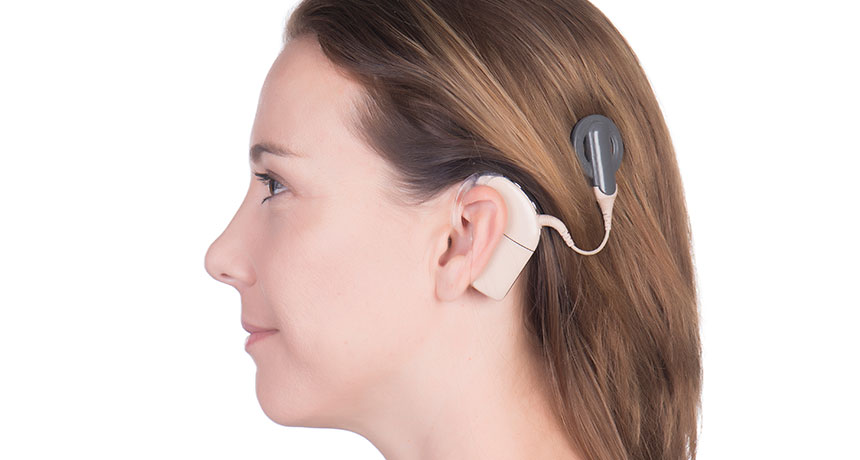 woman wearing cochlear implant