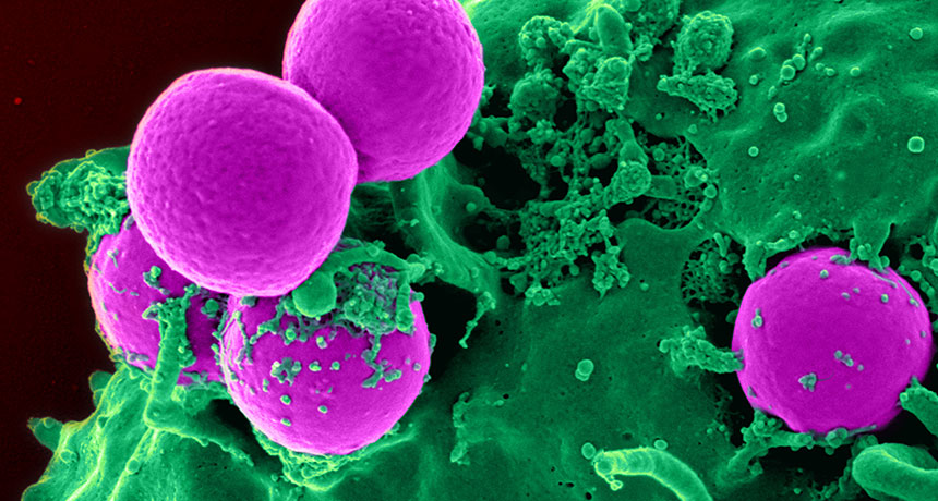 Staphylococcus lugdunensis and MRSA