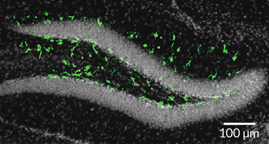 mouse brain