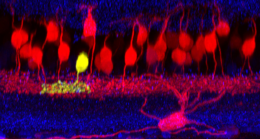 GLuMI nerve cell