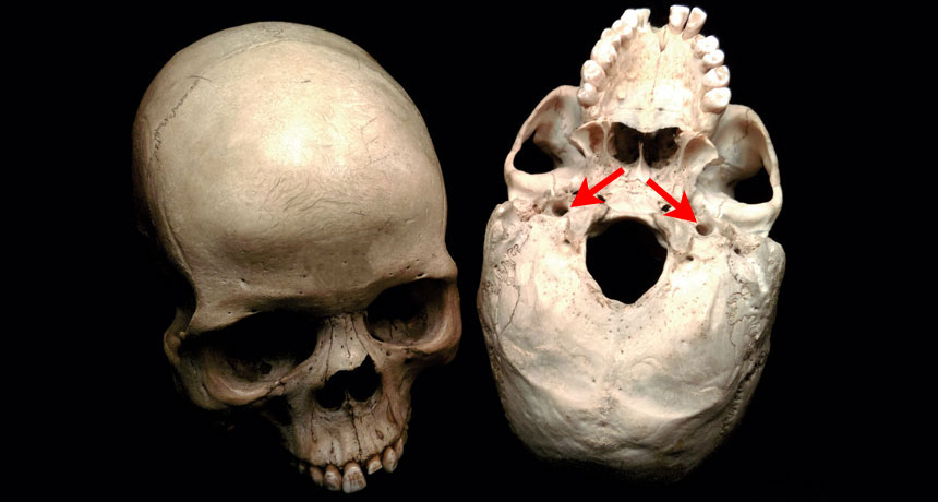 skull