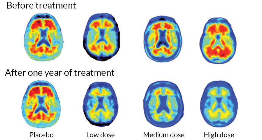 brain scans