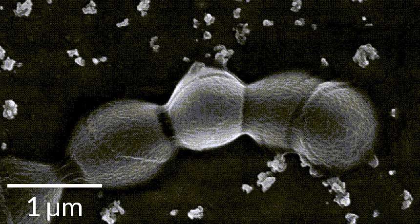 Streptococcus B