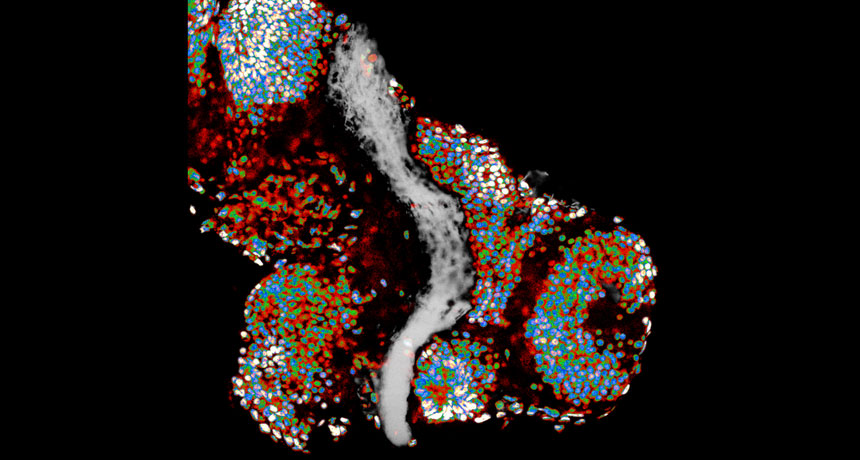 Axons
