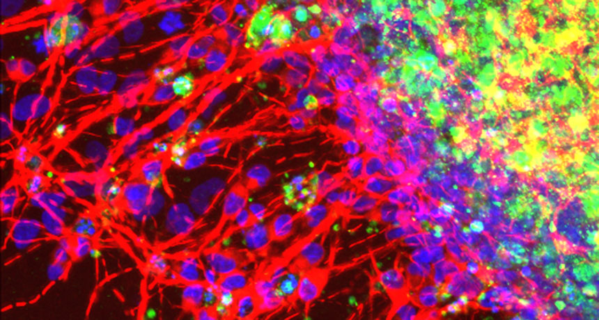 false-color image of cells in minibrain
