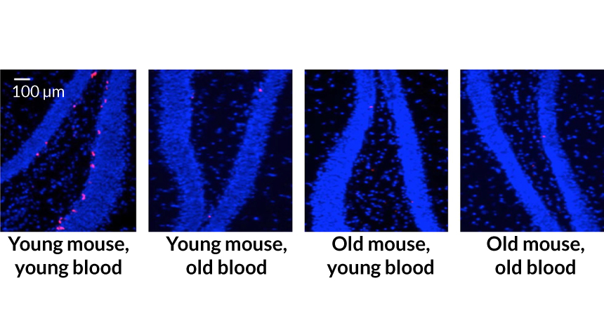 mouse hippocampus