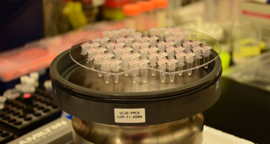 prion blood test