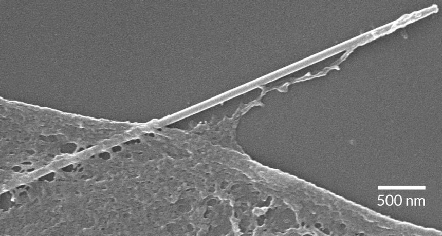 phagocytosis