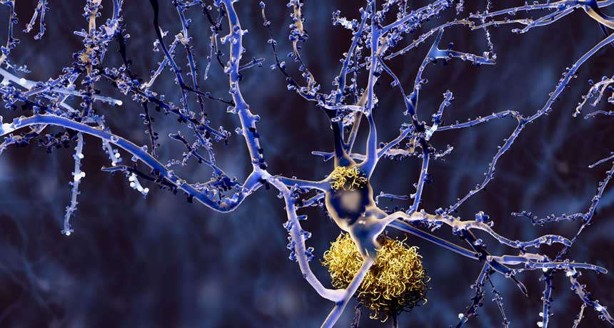 amyloid-beta