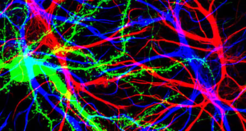 dendritic spines