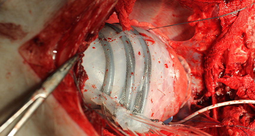 robot heart
