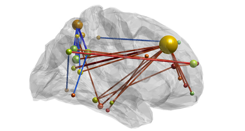 brain links