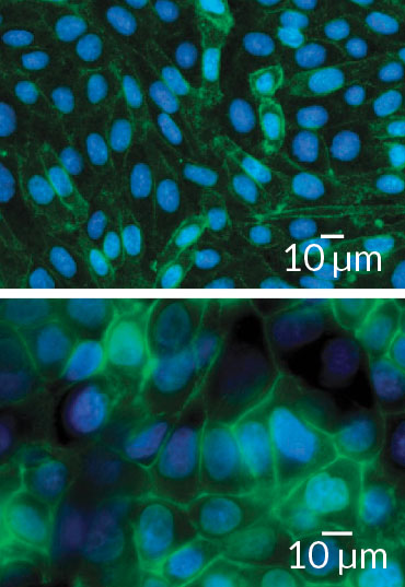 synthetic sialic acids on cancer cells