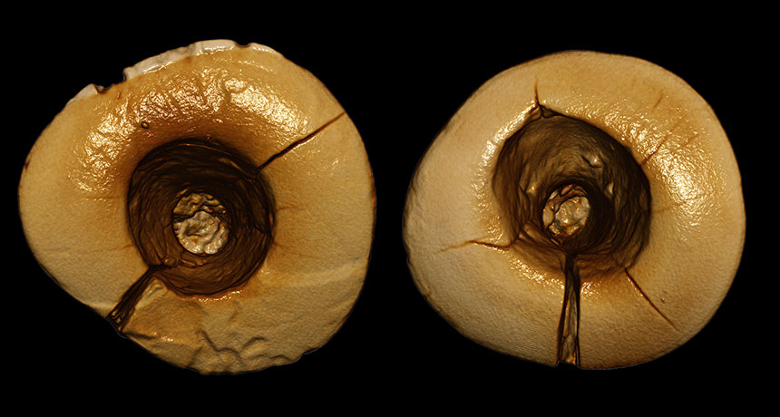ancient tooth decay