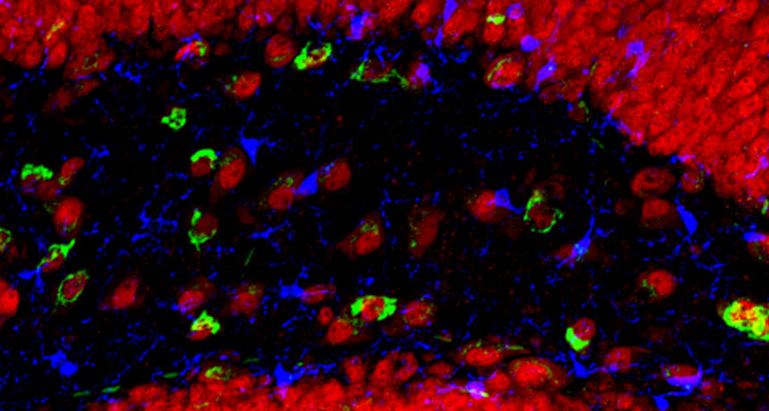 mouse hippocampus