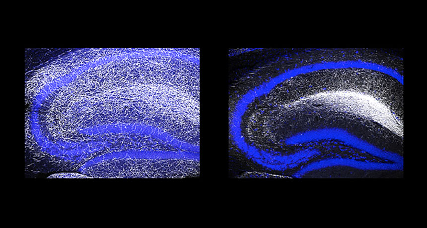 mouse brain