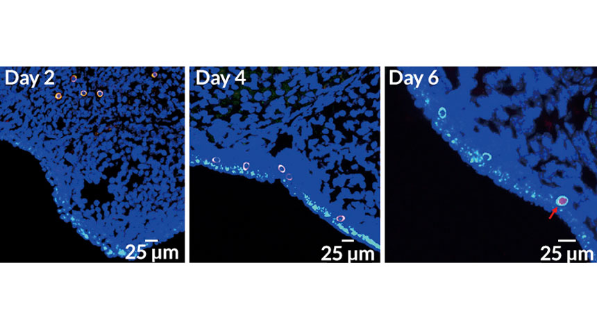 Germline stem cells