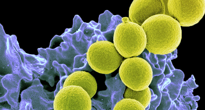 MRSA