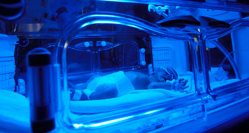 baby light exposure