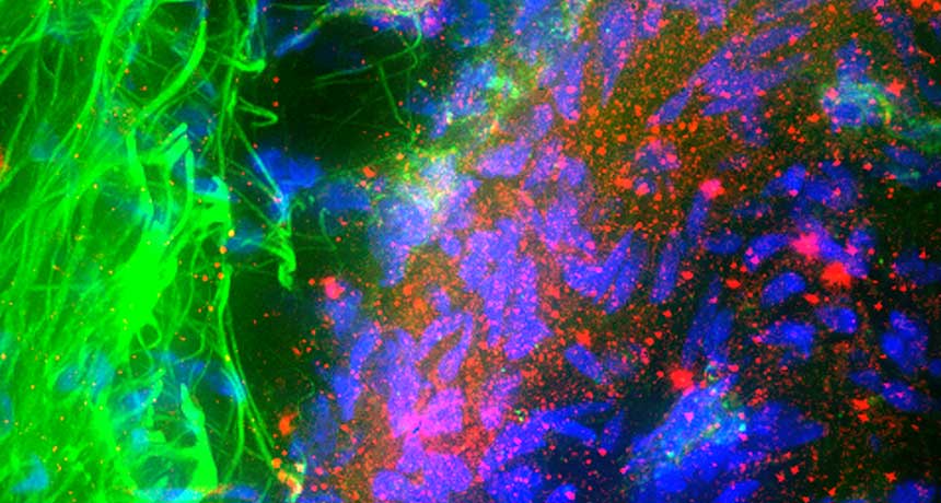 alpha-synuclein protein in nerve cells