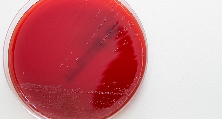 Streptococcus gallolyticus