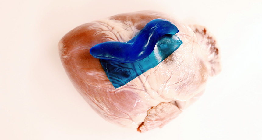 new adhesive on a pig heart