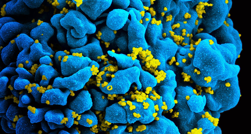 HIV infecting a T cell