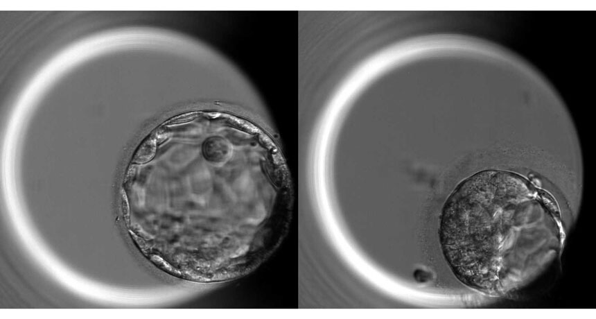 human blastocysts