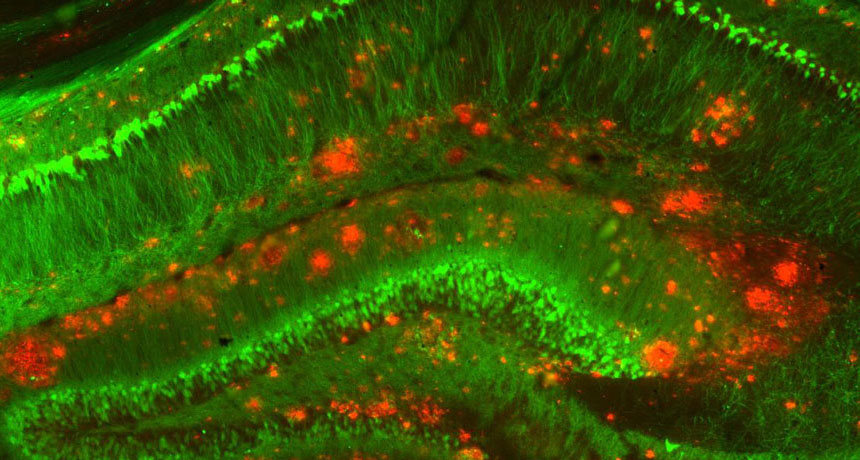 amyloid-beta buildup in mouse brain