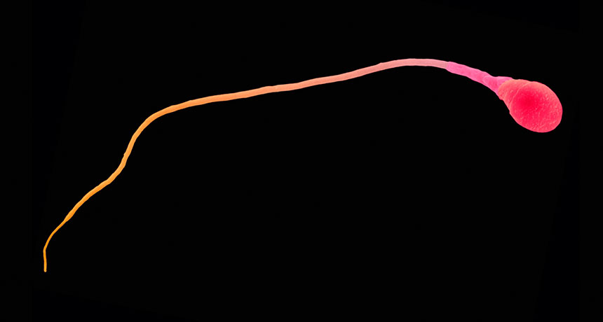 sperm