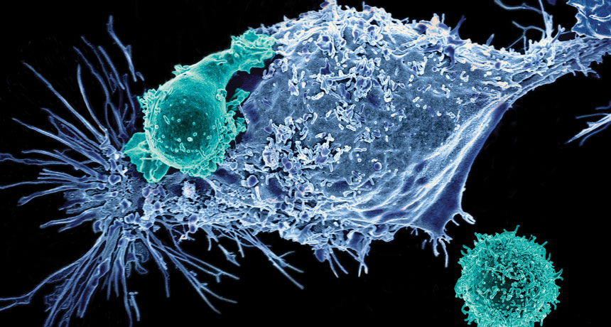 lab test for mesothelioma