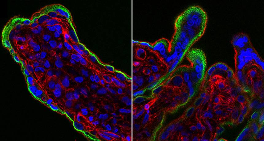 Placental tissue