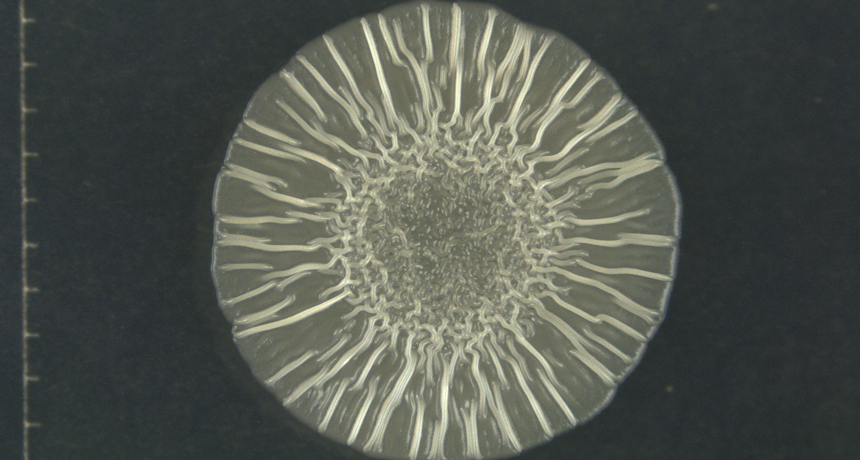 E. coli colony