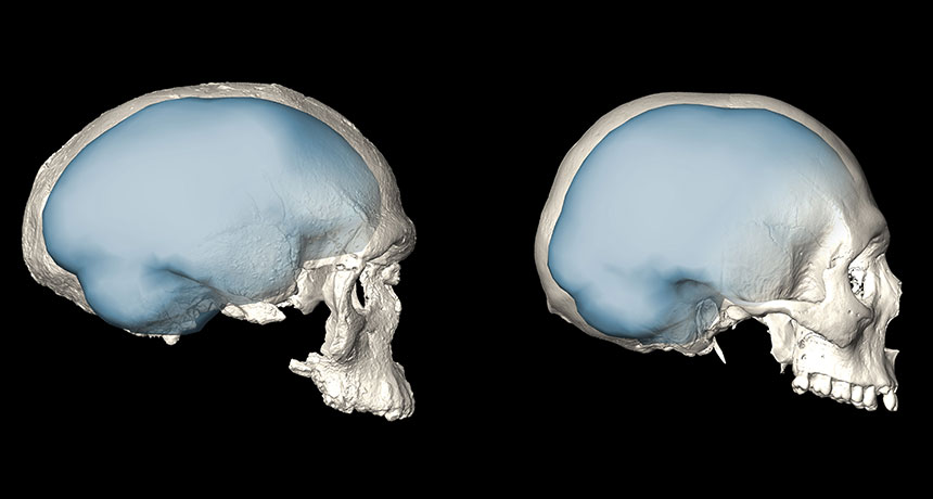 digital brain reconstructions
