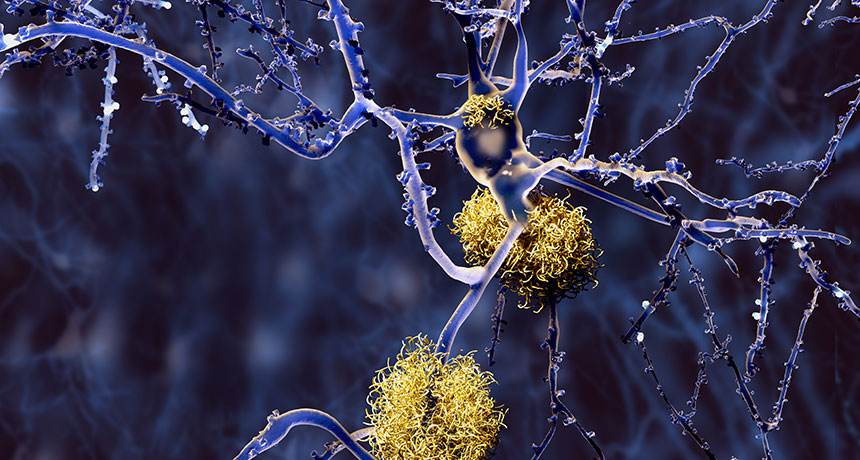 amyloid-beta illustration