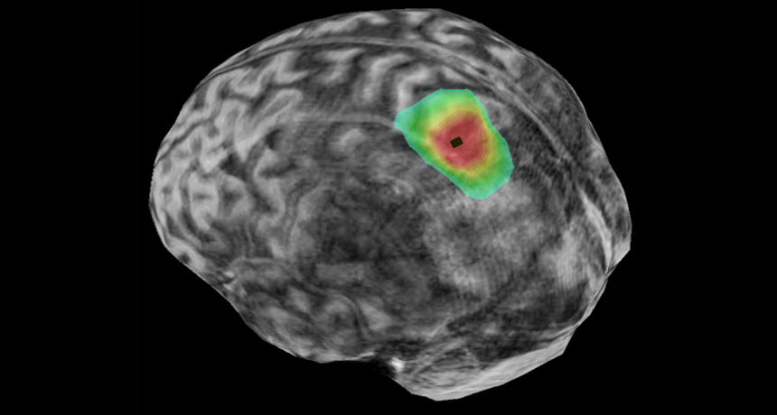 brain