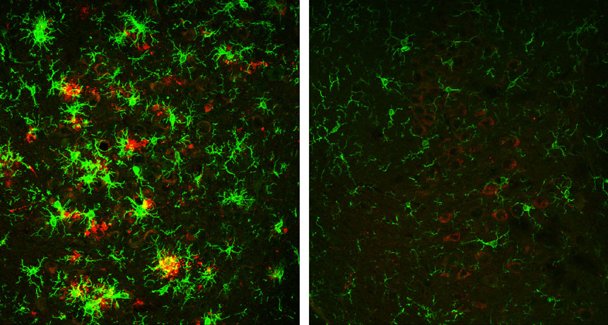 Alzheimer's protein