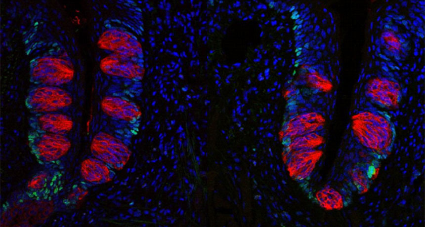 progenitor cells