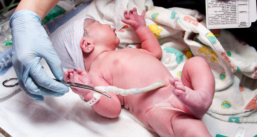 umbilical cord