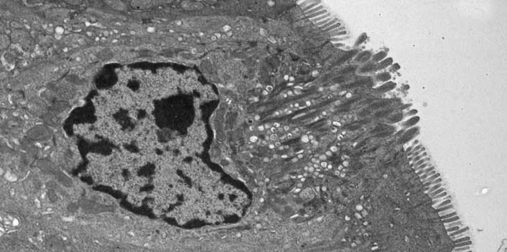 tuft cells