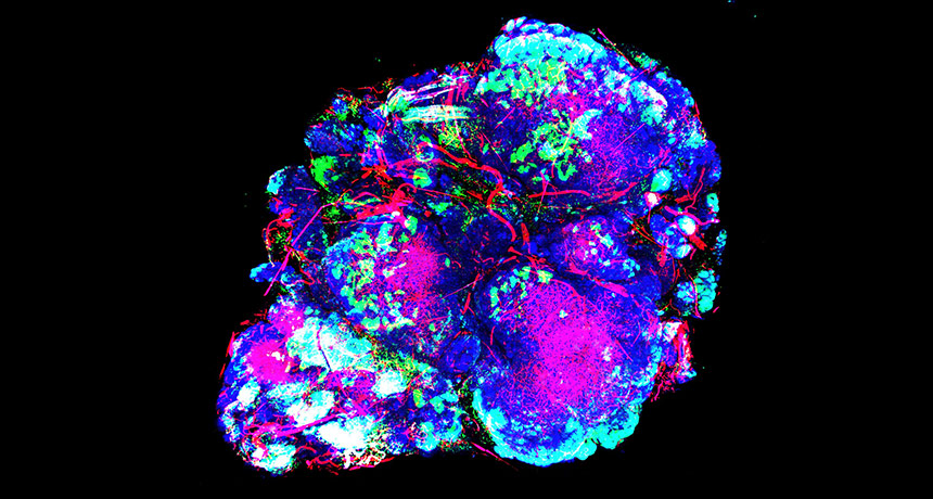 mouse breast tumor