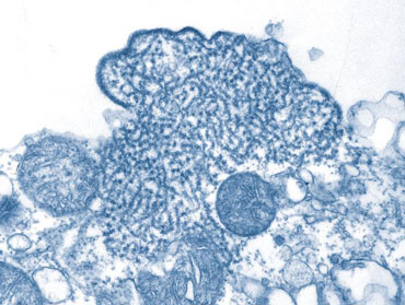 Nipah virus in cells