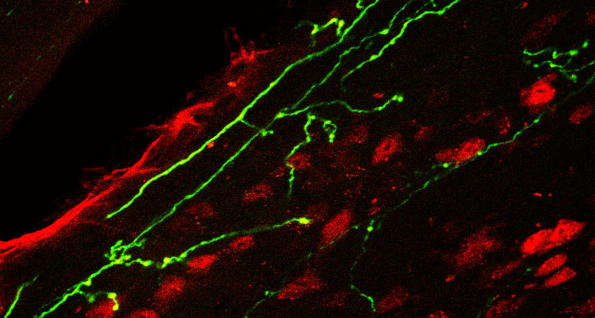 nerve cells