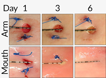 photos of healing arm and mouth skin wounds