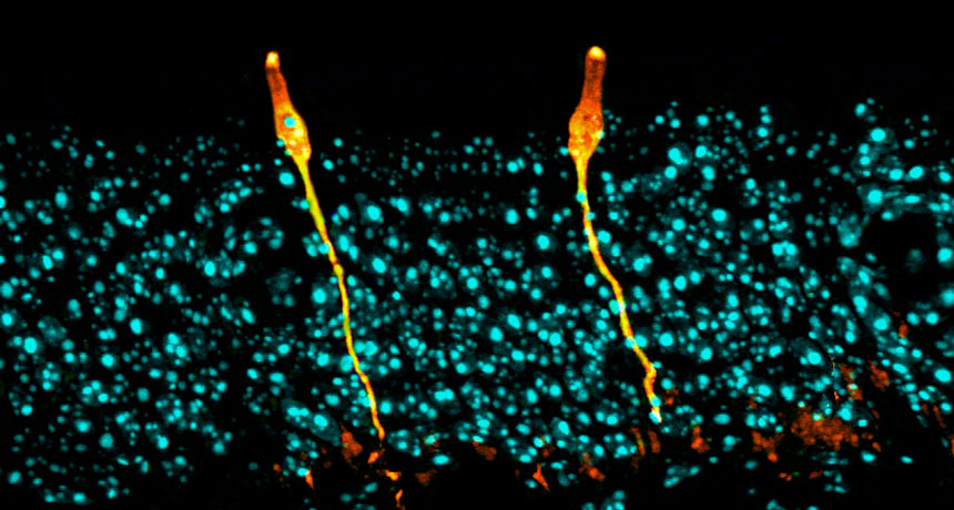 ionocytes