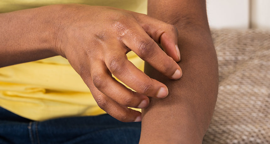 person scratching